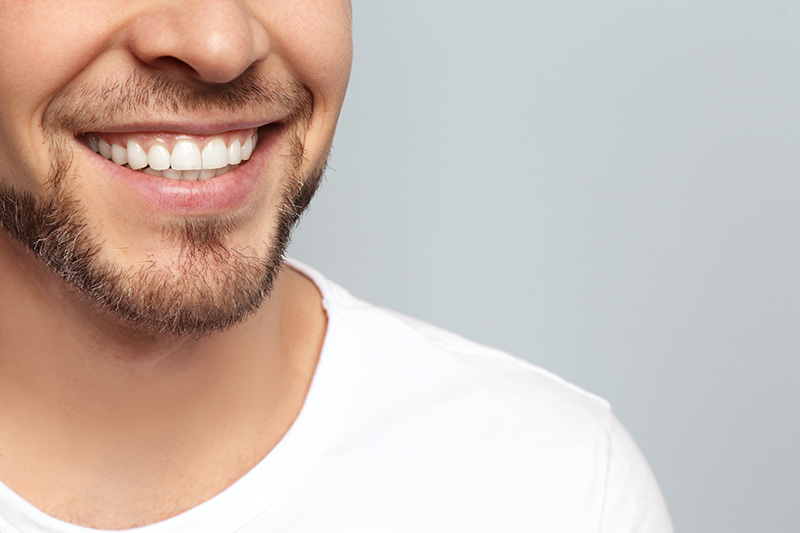 Tooth Whitening